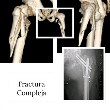 Slider image (2) Dr. Rodrigo Aguirre Rojas Orthopedic Surgeon